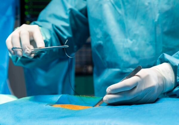 ENT SURGERY DRAPES